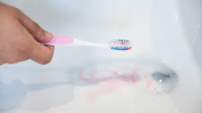 Hands holding toothbrush with bleeding per gum concept